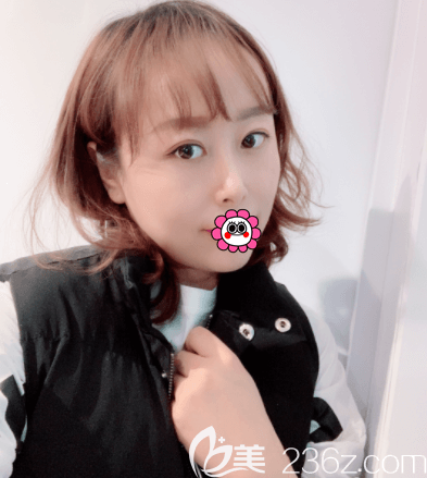 北京惠合嘉美眼綜合案例