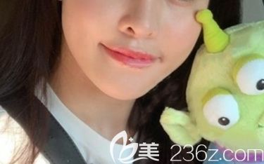 長春姬安娣整形面部輪廓術(shù)后2個月照 長春姬安娣整形面部輪廓術(shù)后2個月照