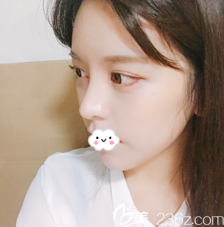 韓國原辰整形醫(yī)院雙眼皮隆鼻<span style= 韓國原辰整形醫(yī)院雙眼皮隆鼻<span style=