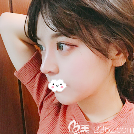 韓國原辰整形醫(yī)院樸原辰做眼睛和隆鼻子怎么樣 韓國原辰整形醫(yī)院樸原辰做眼睛和隆鼻子怎么樣