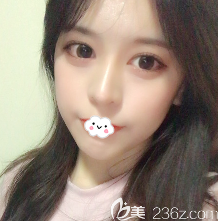 去韓國原辰整形醫(yī)院找樸原辰做完雙眼皮隆鼻和脂肪填充后拿到一份整形價格表