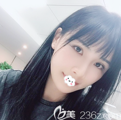 我去深圳非凡找梁全毅做全臉脂肪填充抽的是大腿的脂肪,現(xiàn)在不僅臉變年輕了腿也細了很多