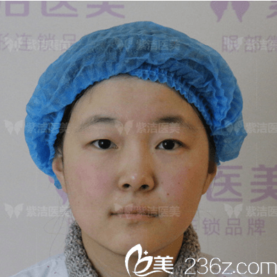 我在北京紫潔做眼綜合前樣子 我在北京紫潔做眼綜合前樣子