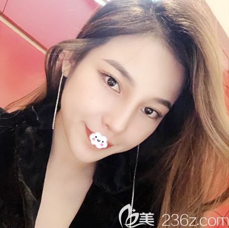 深圳美萊梁志為做隆鼻修復怎么樣 深圳美萊梁志為做隆鼻修復怎么樣