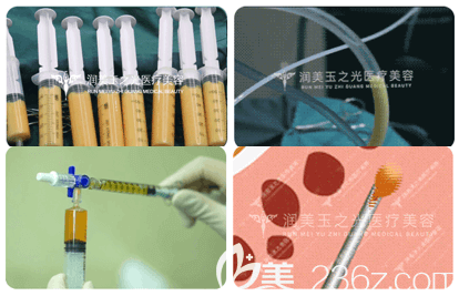 王明利醫(yī)生吸脂隆胸手術(shù)過程示意圖