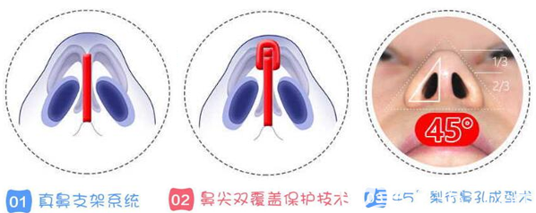 成都銅雀臺整形美容醫(yī)院真鼻子技術(shù)優(yōu)勢 成都銅雀臺整形美容醫(yī)院真鼻子技術(shù)優(yōu)勢