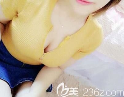 南寧做吸脂隆胸哪家醫(yī)院好？本人在華美整形做腰腹部抽脂和自體脂肪豐胸效果就很棒