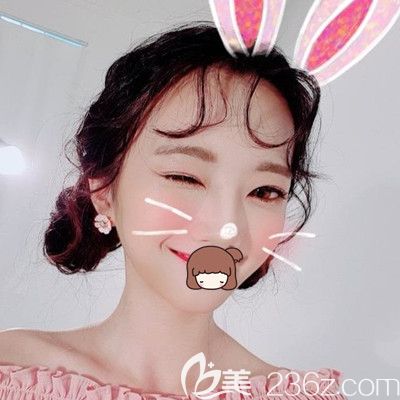 親身經(jīng)歷告訴你我在韓國純真做眼綜合+鼻綜合手術(shù)的效果很好