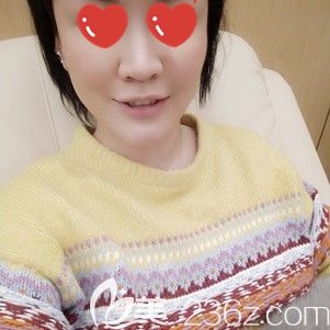 楊國梁院長幫我做自體脂肪面部填充術后面部腫脹