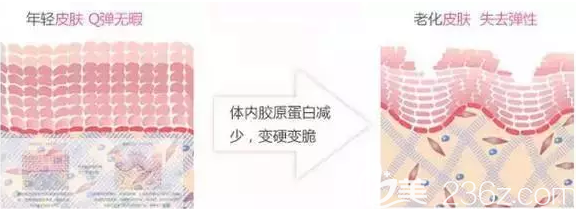 年輕肌膚與老化肌膚對(duì)比
