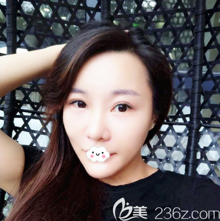 廣州星團(tuán)醫(yī)美童顏術(shù)效果怎么樣 廣州星團(tuán)醫(yī)美童顏術(shù)效果怎么樣