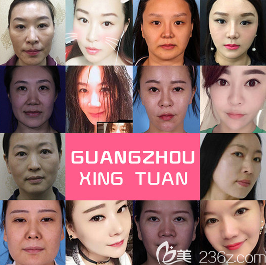 廣州星團(tuán)醫(yī)美廖均平做的童顏<span style=