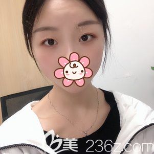 面診南京華韓奇致術(shù)前眼部缺陷較大 面診南京華韓奇致術(shù)前眼部缺陷較大