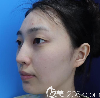 20190718_1563434005834315.png image.png