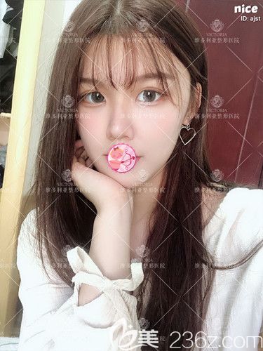 聽別人說做完眼綜合都丑了 可當(dāng)我看到張家口維多利亞眼部整形案例還是選擇孫凱醫(yī)生做了切開雙眼皮和開眼角手術(shù)效果如我預(yù)想那樣