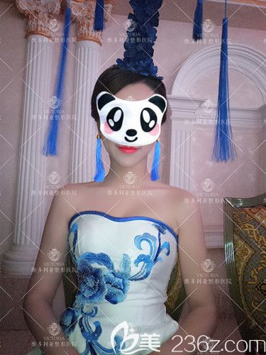 李成輝醫(yī)生為我做曼托假體隆胸術后1個月胸部豐滿挺拔 李成輝醫(yī)生為我做曼托假體隆胸術后1個月胸部豐滿挺拔