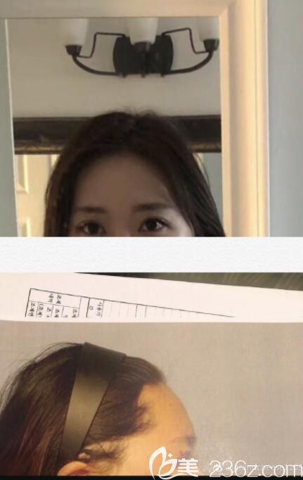 20190722_1563764368465269.jpg 術(shù)前.jpg