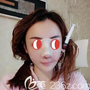 楊國梁院長幫我做鼻部修復術(shù)后即刻