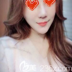 在<!--<i data=20240703-sp></i>-->做鼻綜合術(shù)后20天恢復(fù)效果 在<!--<i data=20240703-sp></i>-->做鼻綜合術(shù)后20天恢復(fù)效果