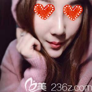 湖南整形醫(yī)院怎么樣？看我找符恒做硅膠假體+耳軟骨綜合隆鼻術后40天恢復效果圖就知道了！