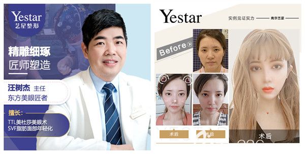 汪樹(shù)杰主任眼部整形案例