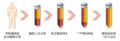 廣州紫馨梁進(jìn)華醫(yī)生自體脂肪萃取技術(shù)優(yōu)勢(shì) 廣州紫馨梁進(jìn)華醫(yī)生自體脂肪萃取技術(shù)優(yōu)勢(shì)