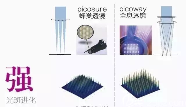 Picoway超皮秒祛斑優(yōu)勢(shì)