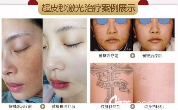 7.29-31到無(wú)錫坤如瑪麗還可享受全臉美白1980元的特惠價(jià)格