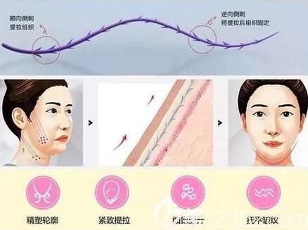 面部線雕多少歲做合適？