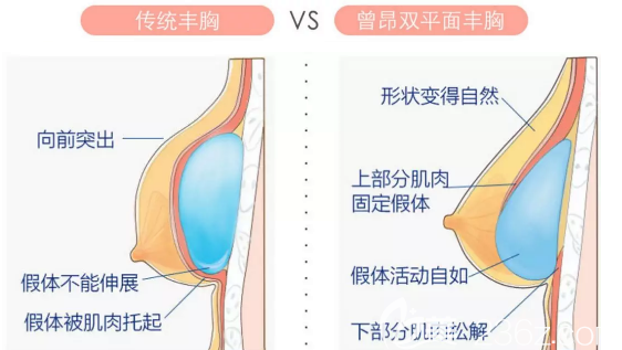 <!--<i data=20240703-sp></i>-->曾昂醫(yī)生隆胸手術(shù)優(yōu)勢(shì)