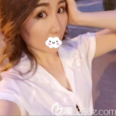 自體脂肪豐胸術(shù)前照片 自體脂肪豐胸術(shù)前照片