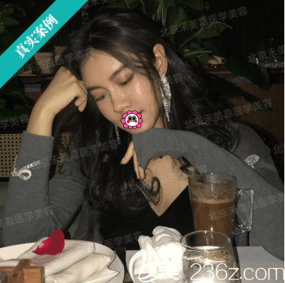 用我在北京禾美嘉做面部脂肪加減法價(jià)格和效果告知你任學(xué)會(huì)脂肪填充好嗎