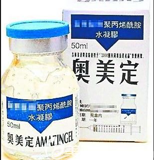 液態(tài)分子豐胸術就是奧美定豐胸