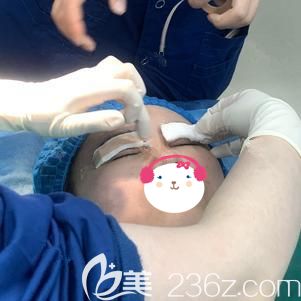 <!--<i data=20240703-sp></i>-->主任幫我做埋線(xiàn)雙眼皮術(shù)后包扎