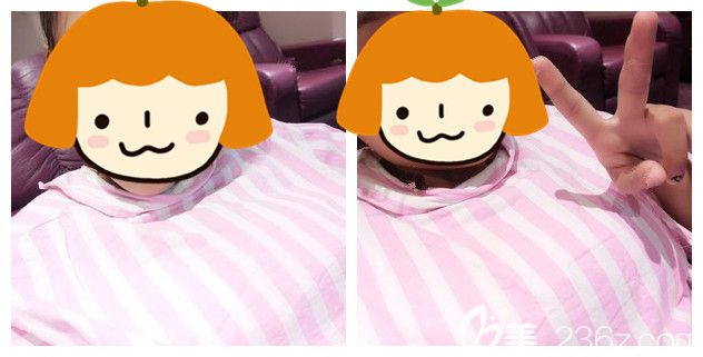 剛做完威寧之星假體隆胸術(shù)后即刻效果 剛做完威寧之星假體隆胸術(shù)后即刻效果