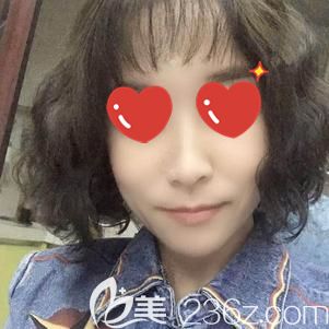 到武漢藝星做玻尿酸去法令紋術(shù)后60天青春感滿滿 到武漢藝星做玻尿酸去法令紋術(shù)后60天青春感滿滿