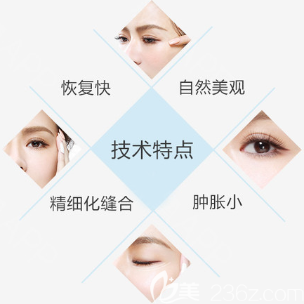 深圳yestar藝星整形常德成醫(yī)生雙眼皮手術(shù)特點(diǎn)