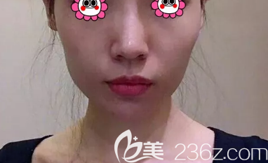 20190729_1564388199147873.png blob.png