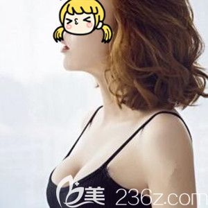 看海南瑞韓醫(yī)學(xué)美容醫(yī)院楊永成給我做的進(jìn)口曼托假體隆胸術(shù)后30天恢復(fù)效果圖怎么樣！