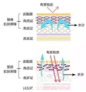 健康肌膚與受損肌膚組織層