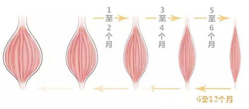 注射瘦臉維持時間較久