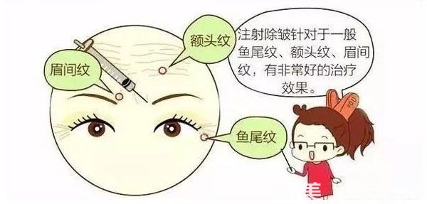 面部除皺針有什么作用呢