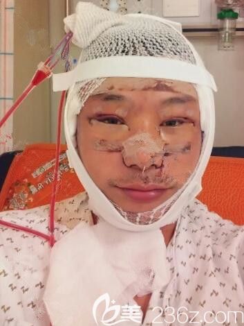 20190730_1564477535584251.jpg 手術(shù)當(dāng)天_副本.jpg