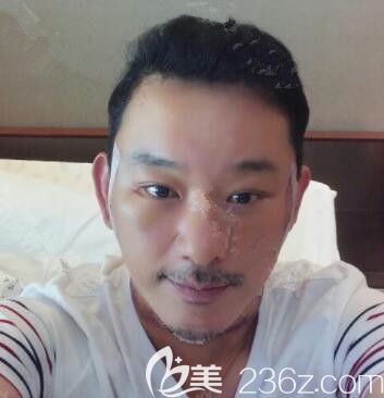 20190730_1564477801141650.jpg 術(shù)后2周_副本.jpg