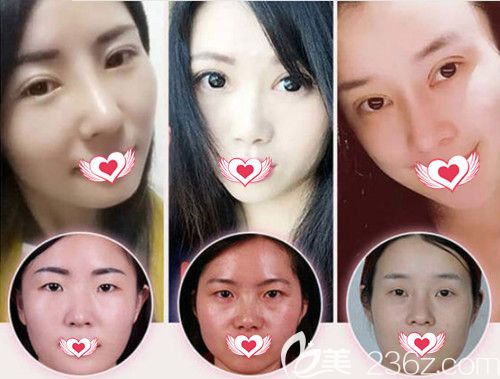 做雙眼皮手術(shù)<span style= 做雙眼皮手術(shù)<span style=