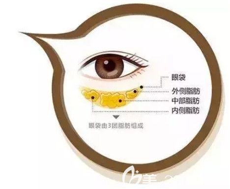 眼袋形成原因