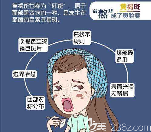 黃褐斑在臉上的表現(xiàn)形式