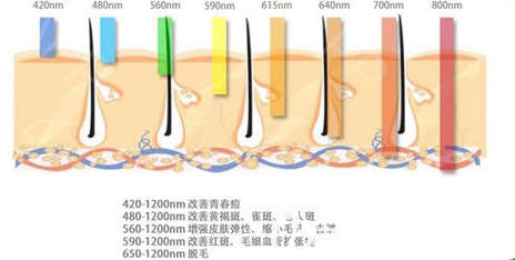 光子嫩膚的能量范圍