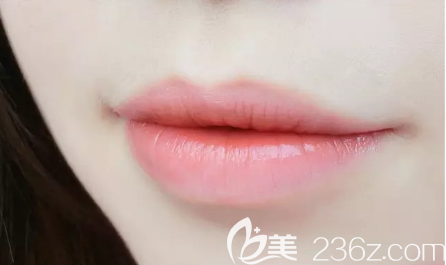 唇部整形需要多少錢