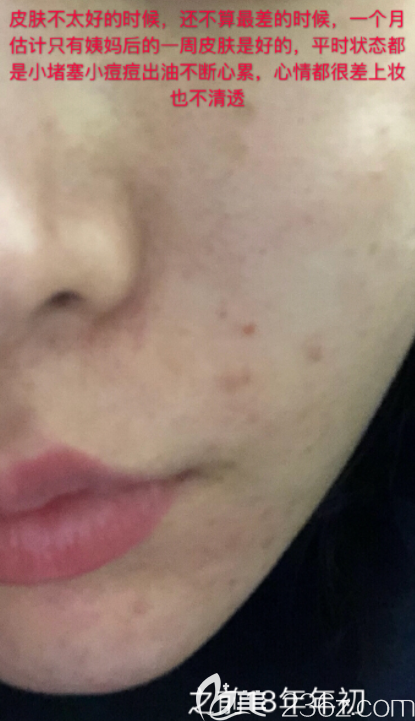 20190731_1564562693766762.png 20190731_1564562693766762.png